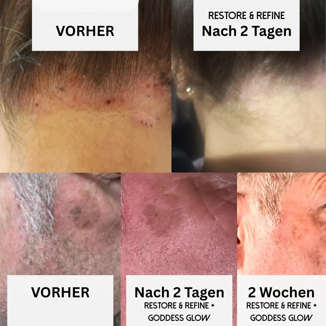 Restore & Refine - Hautverfeinernde Tagescreme - MOOD Naturals